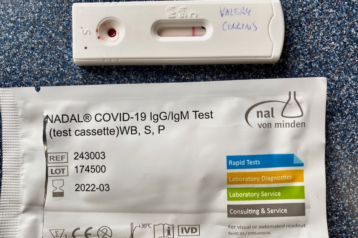 My COVID 19 Antibodies Test